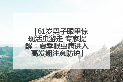 61岁男子眼里惊现活虫游走 专家提醒：夏季眼虫病进入高发期注意防护